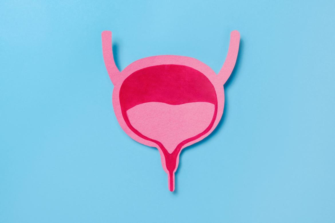Bladder Biopsy
