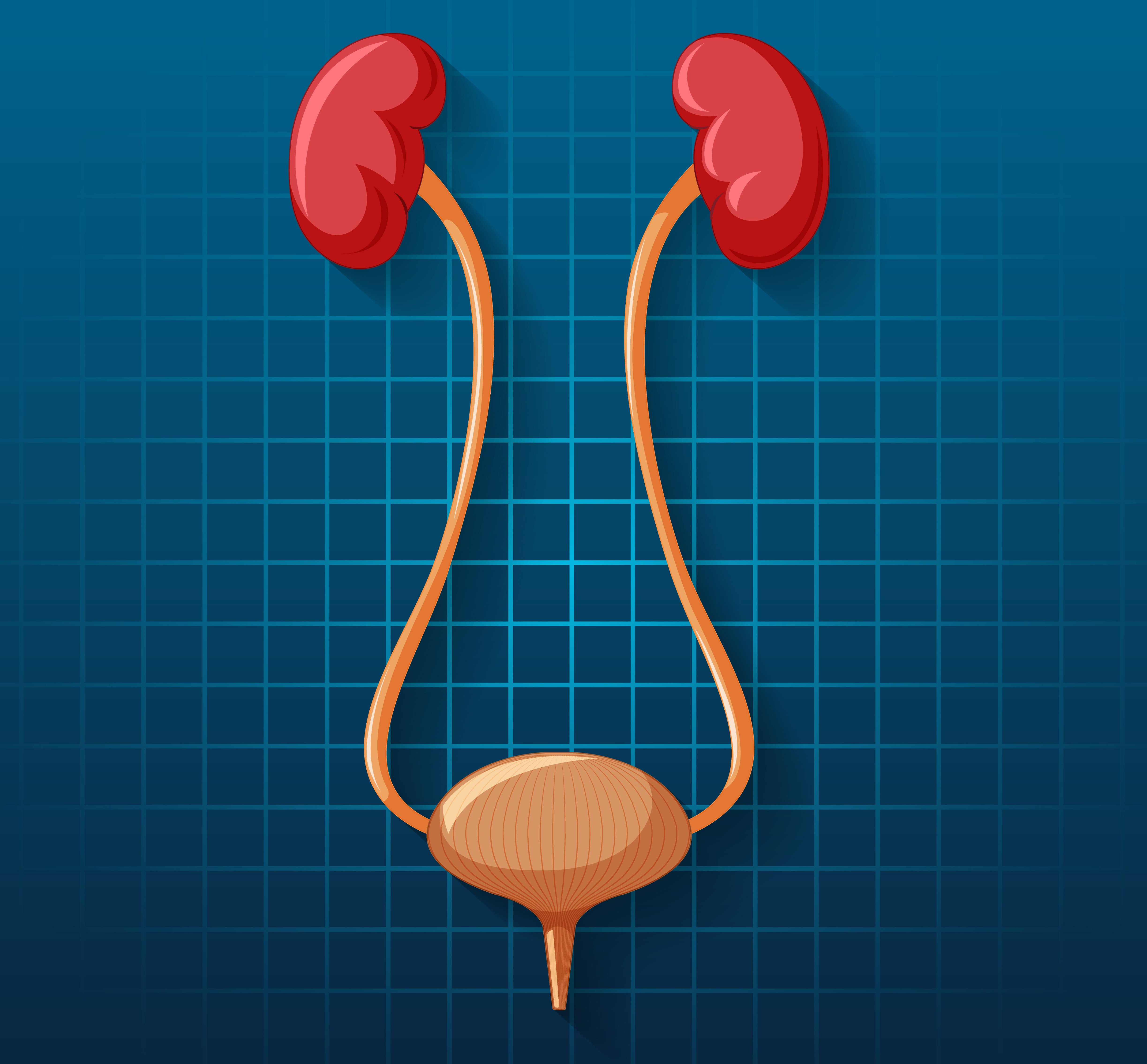 What is Nephrostomy? How is it Performed?