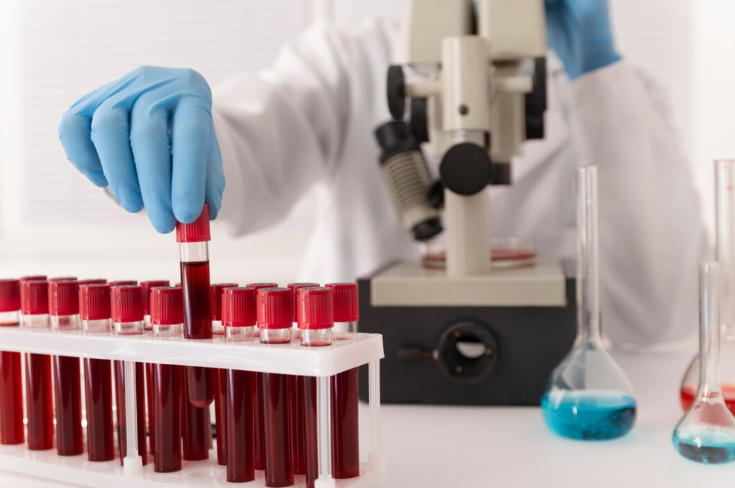 Blood Test