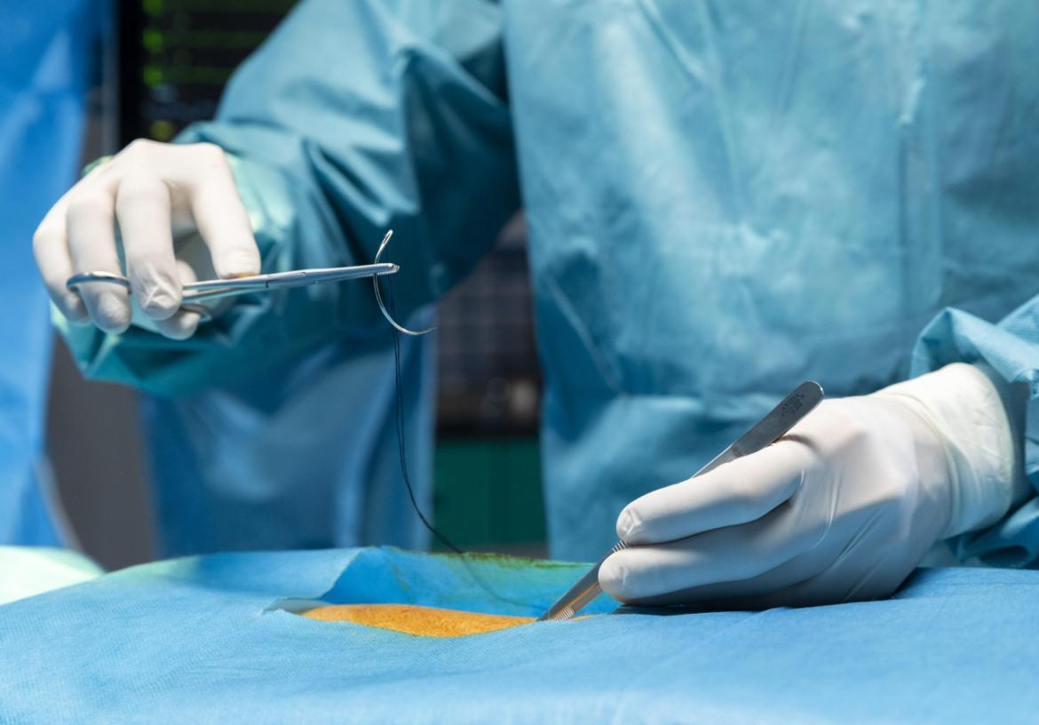 Vasectomy Surgery