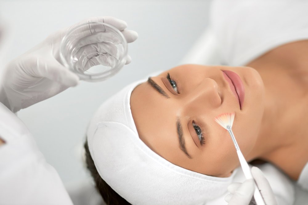 What is Chemical Peeling (Skin Rejuvenation)?