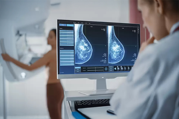 Mammography & Digital Mammography
