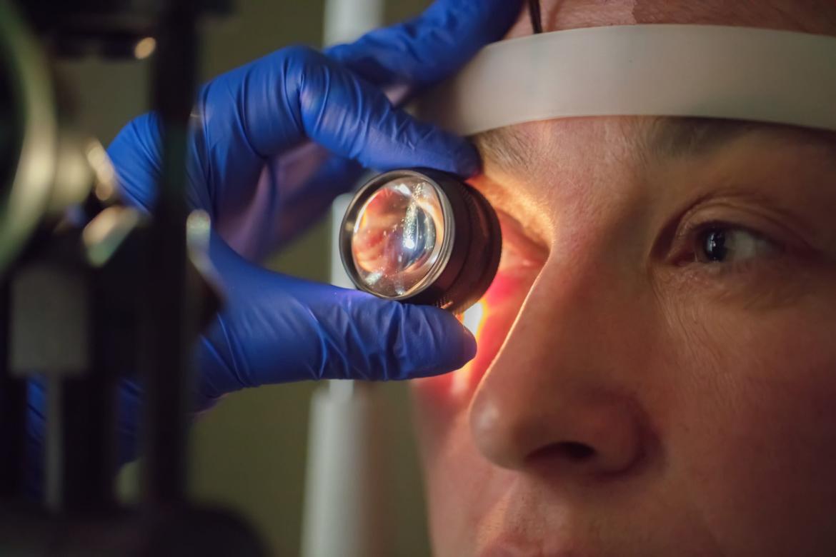 Cataract Surgery