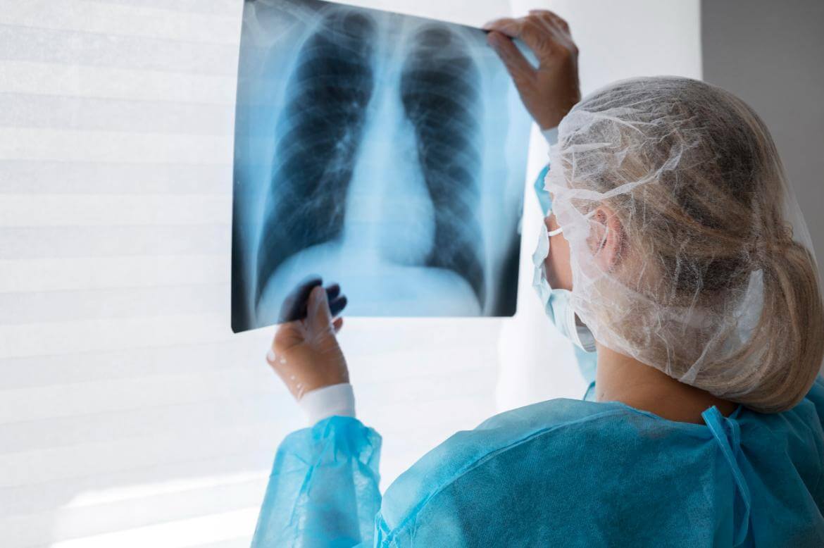 What is Pulmonary Hemorrhage: Symptoms, Causes and Treatment Methods