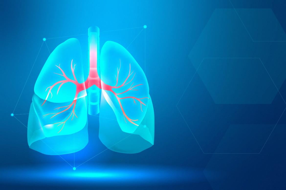 Lung Cancer