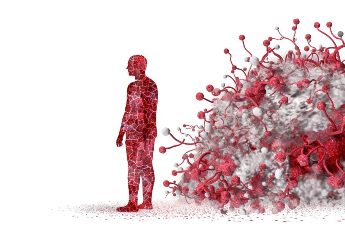 Acromegaly Disease Symptoms and Causes