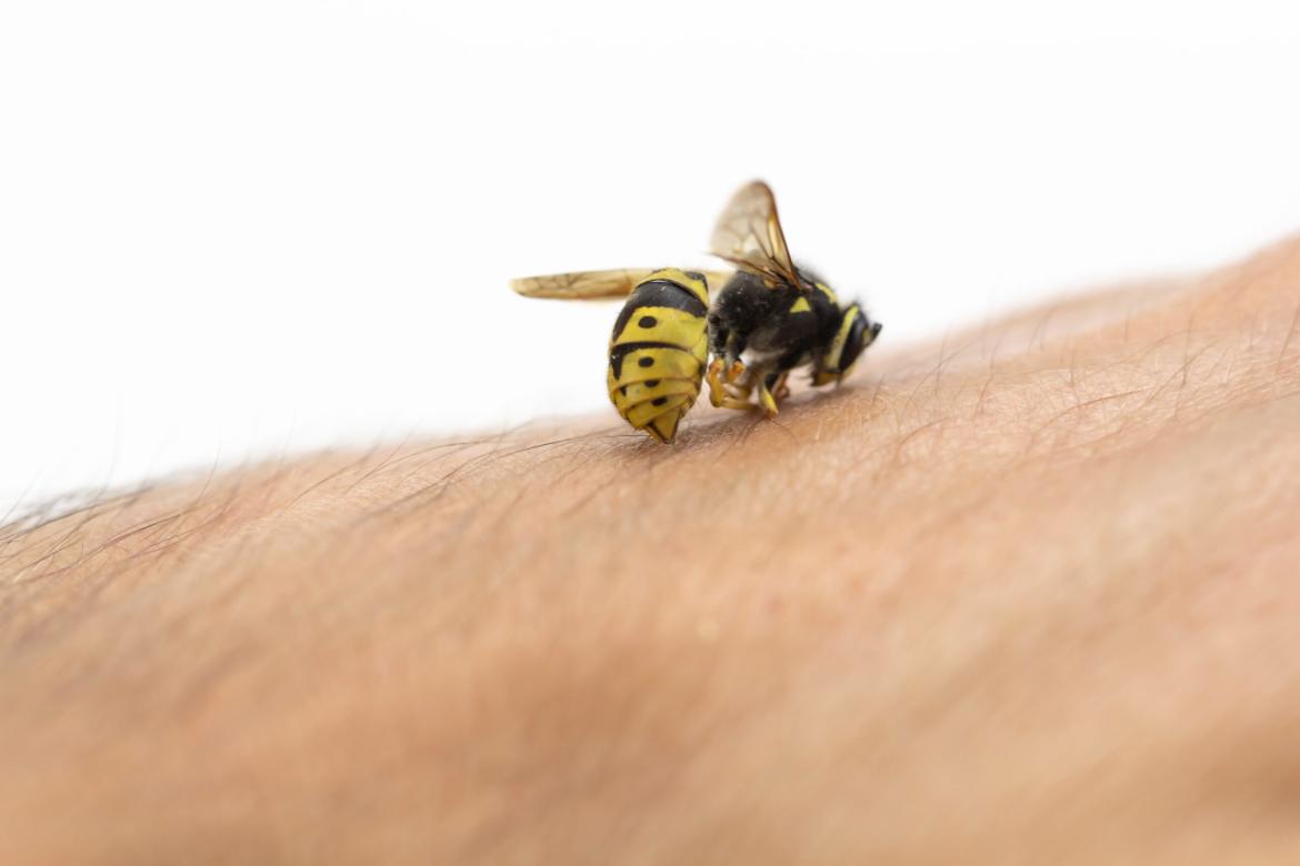 Natural Treatment Methods After a Bee Sting: What is Good for a Bee Sting?