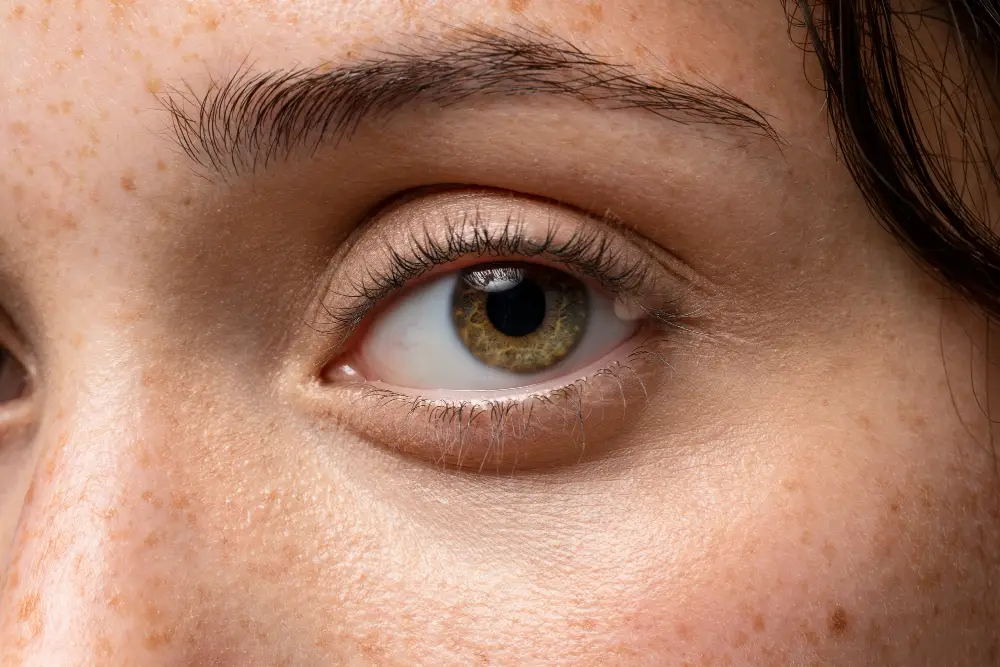 Stye Surgery