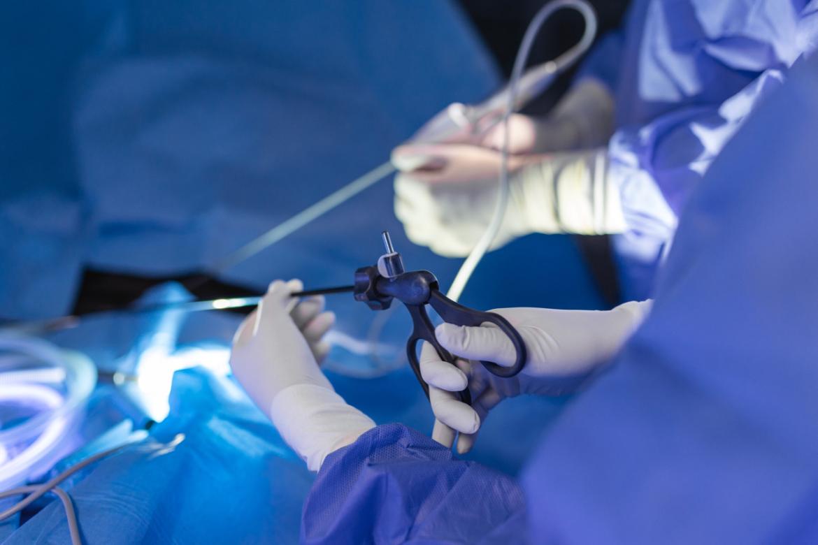 Arthroscopy Surgery