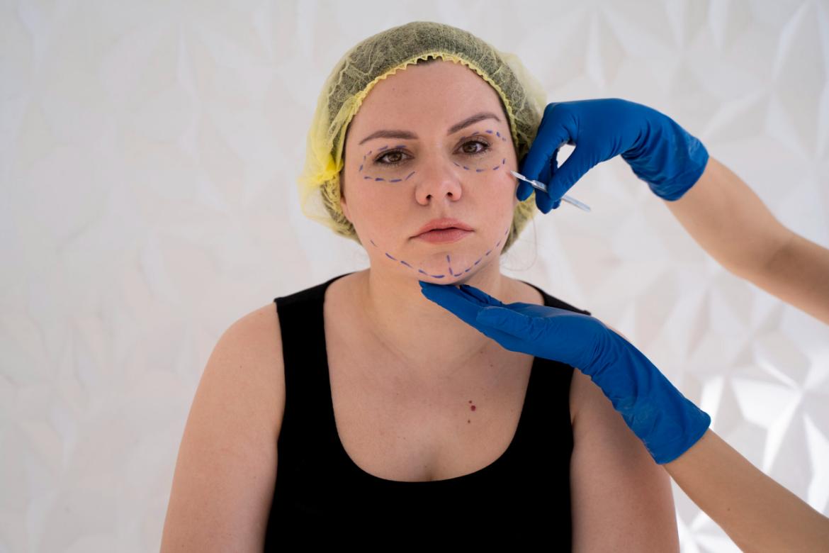 Asymmetrical Face Surgery (Profiloplasty)
