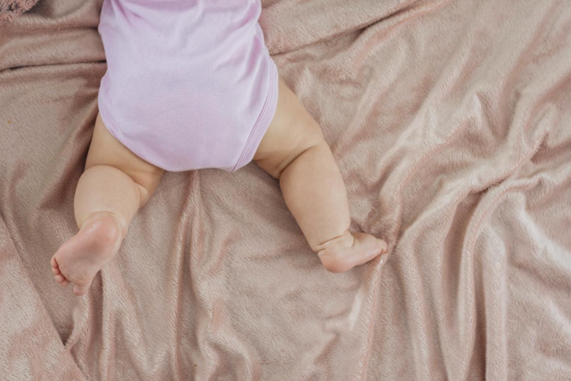 Hip Dislocation in Infants