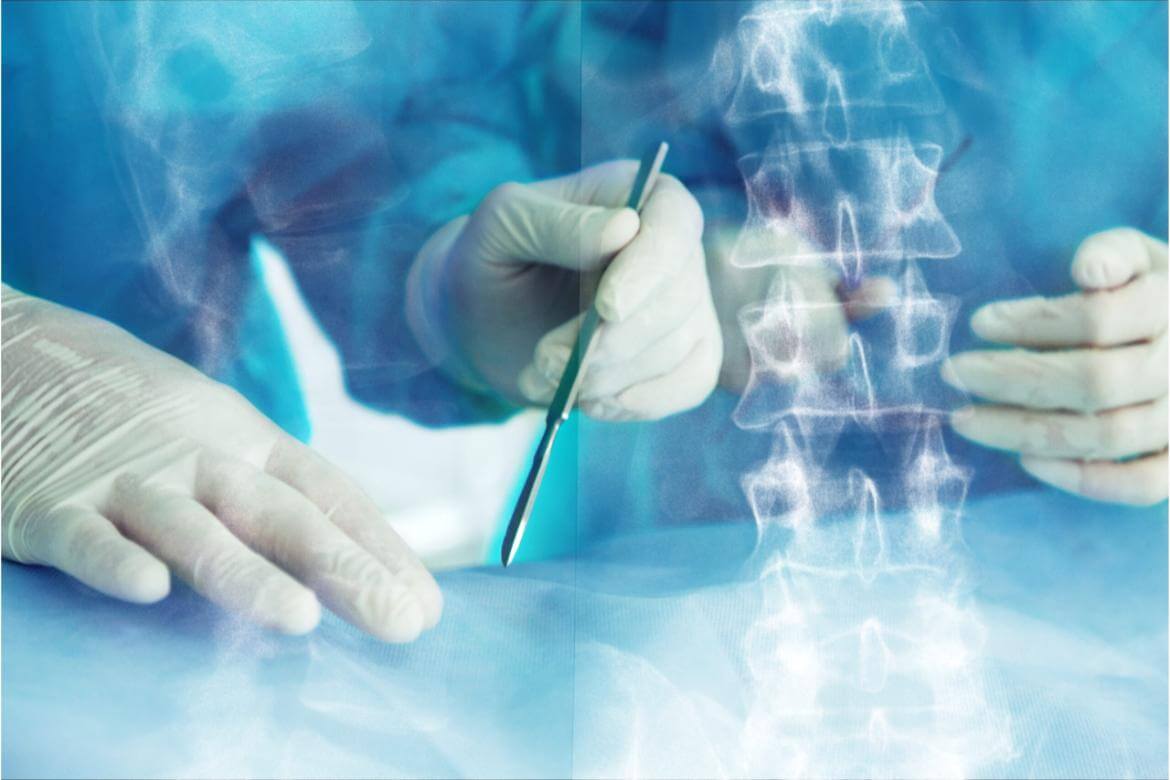 Herniated Disc Surgery