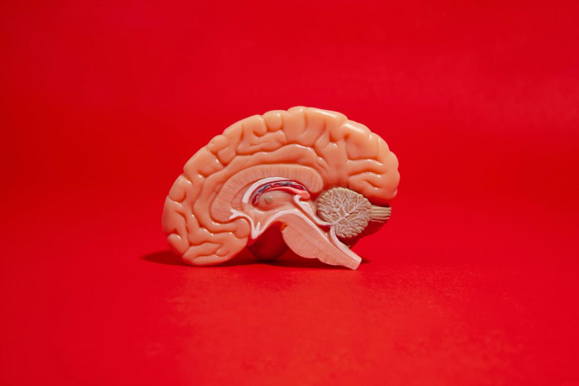 Cerebellar Prolapse