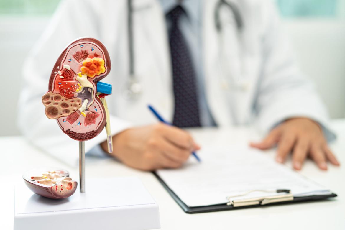 Kidney Cancer Surgery
