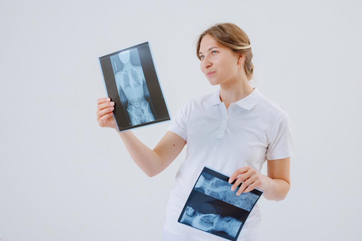 Brittle Bone Disease (Osteogenesis Imperfecta)