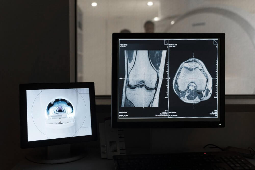 Interventional Radiology
