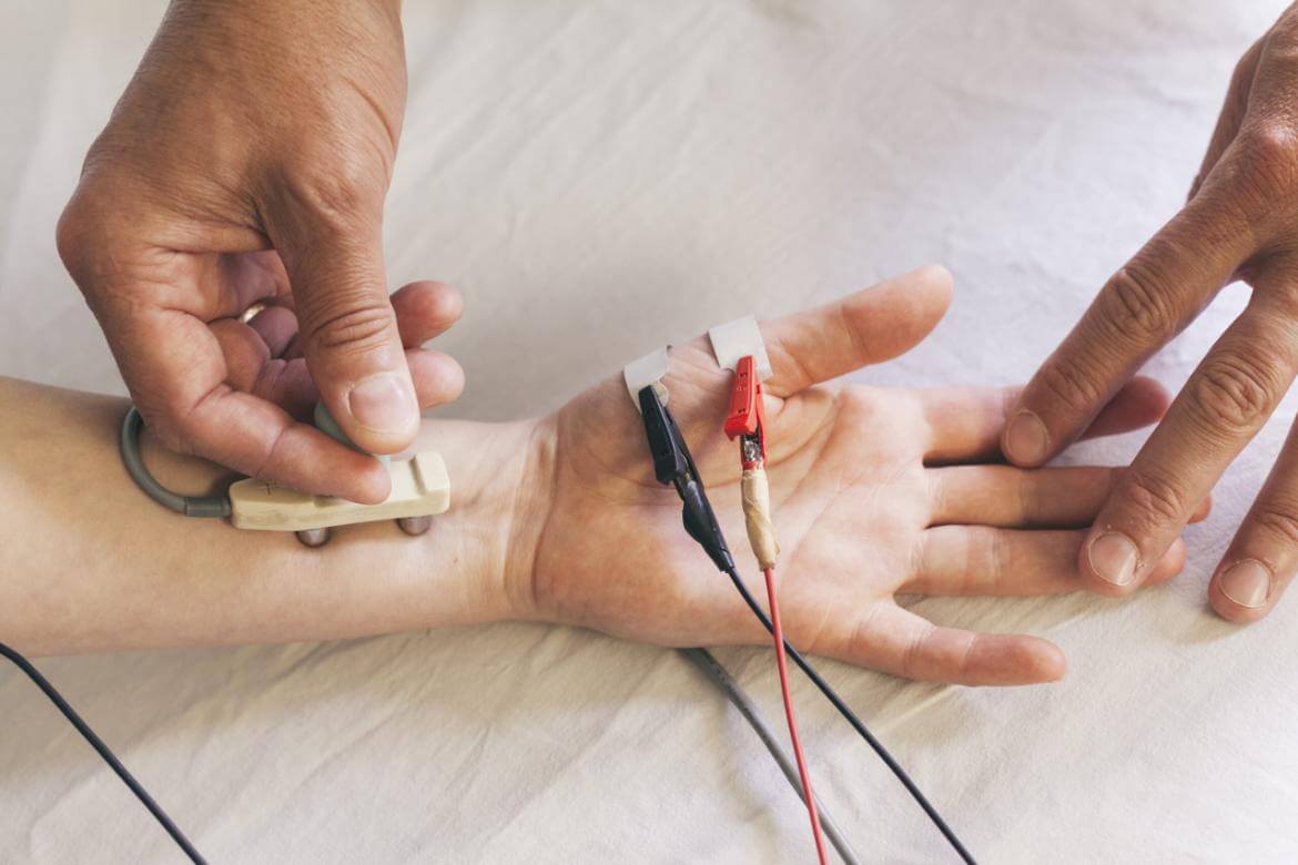Nerve Compression