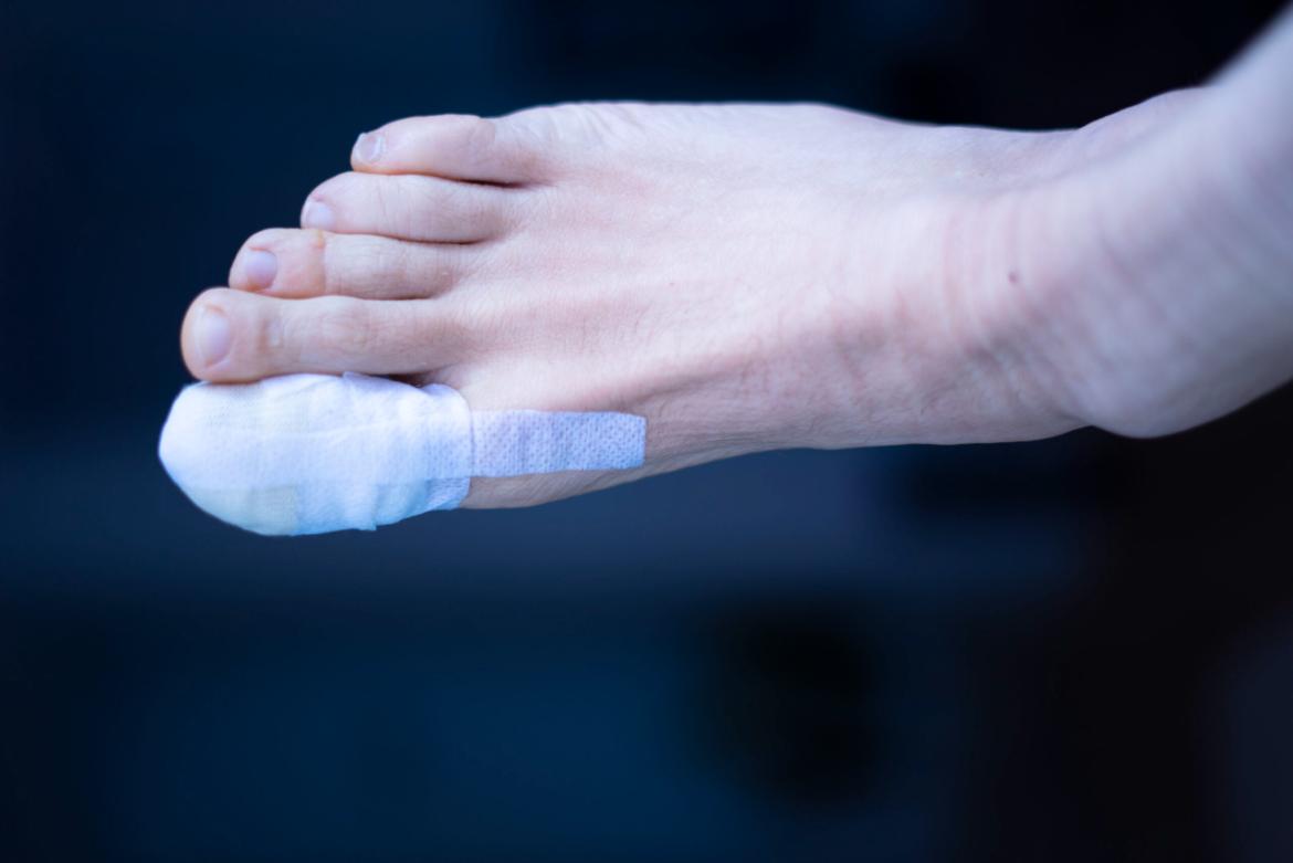 Diabetic Foot