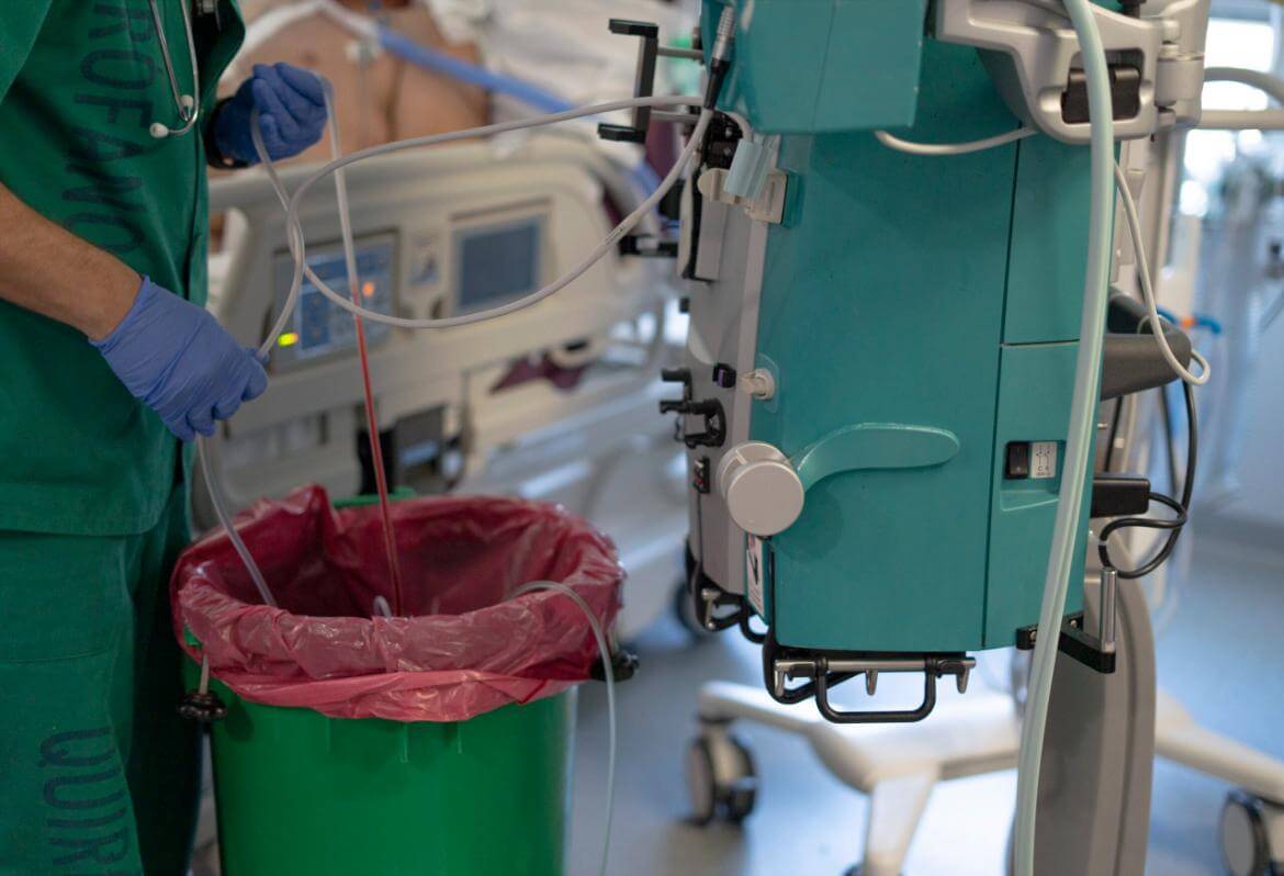 What is a Dialysis Fistula?