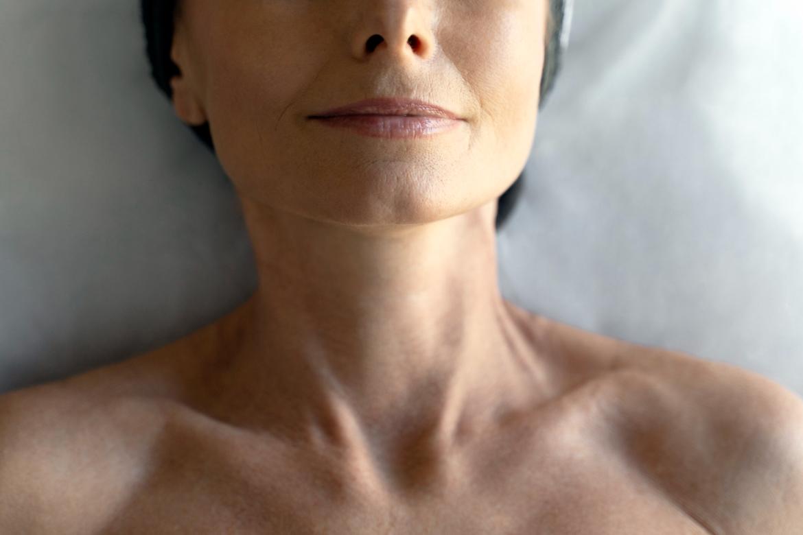 Torticollis (Curvy Neck Disease)