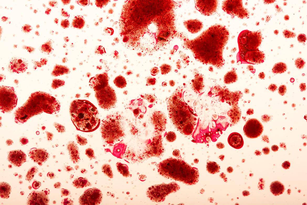 Eris Variant (Virus)