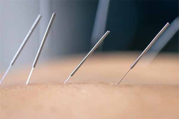 Acupuncture Center