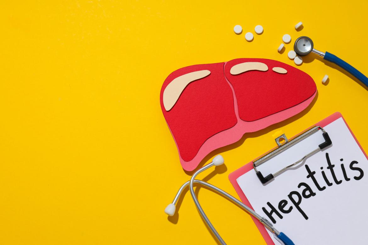 Hepatitis D