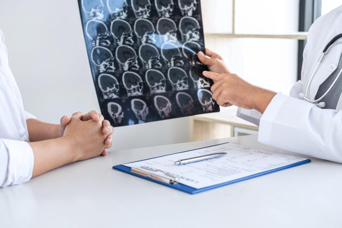 Stroke Symptoms