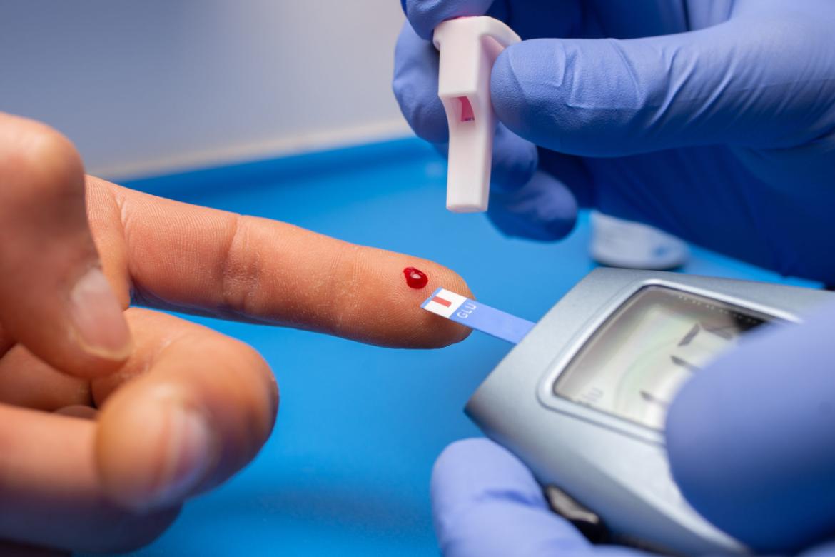 Insulin Resistance Test (HOMA-IR)