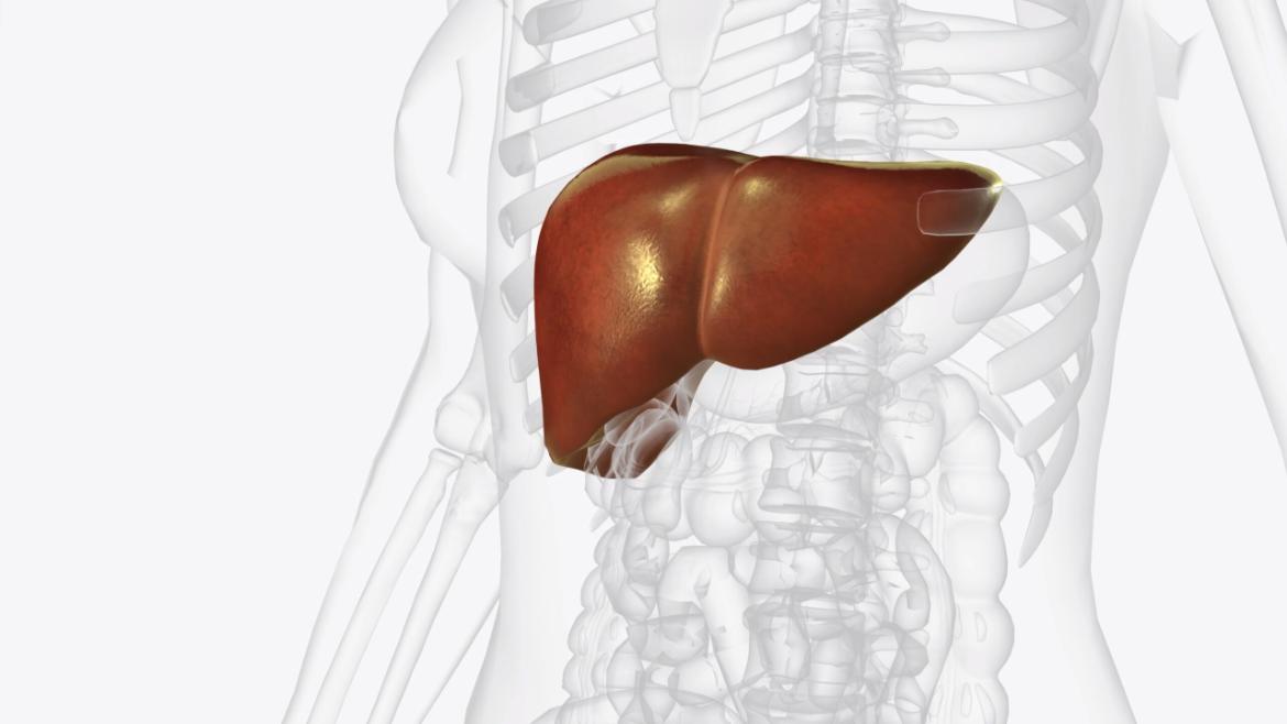 Liver Cyst