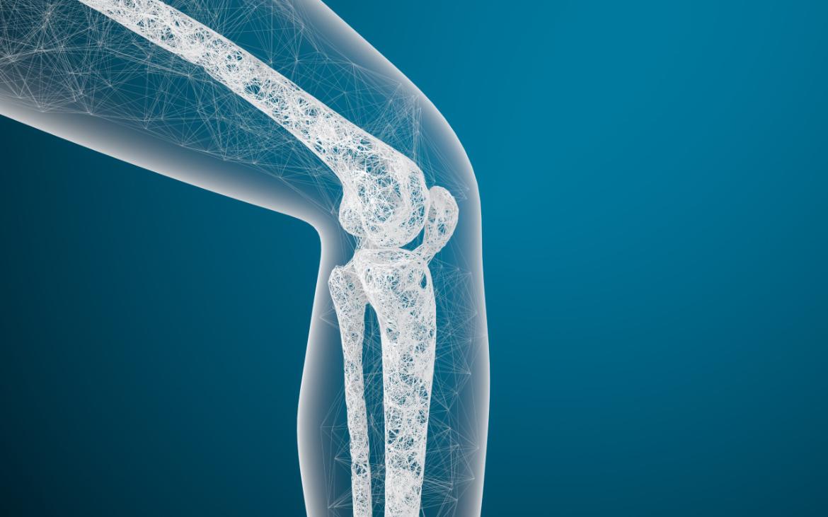 Bone Inflammation (Osteomyelitis)