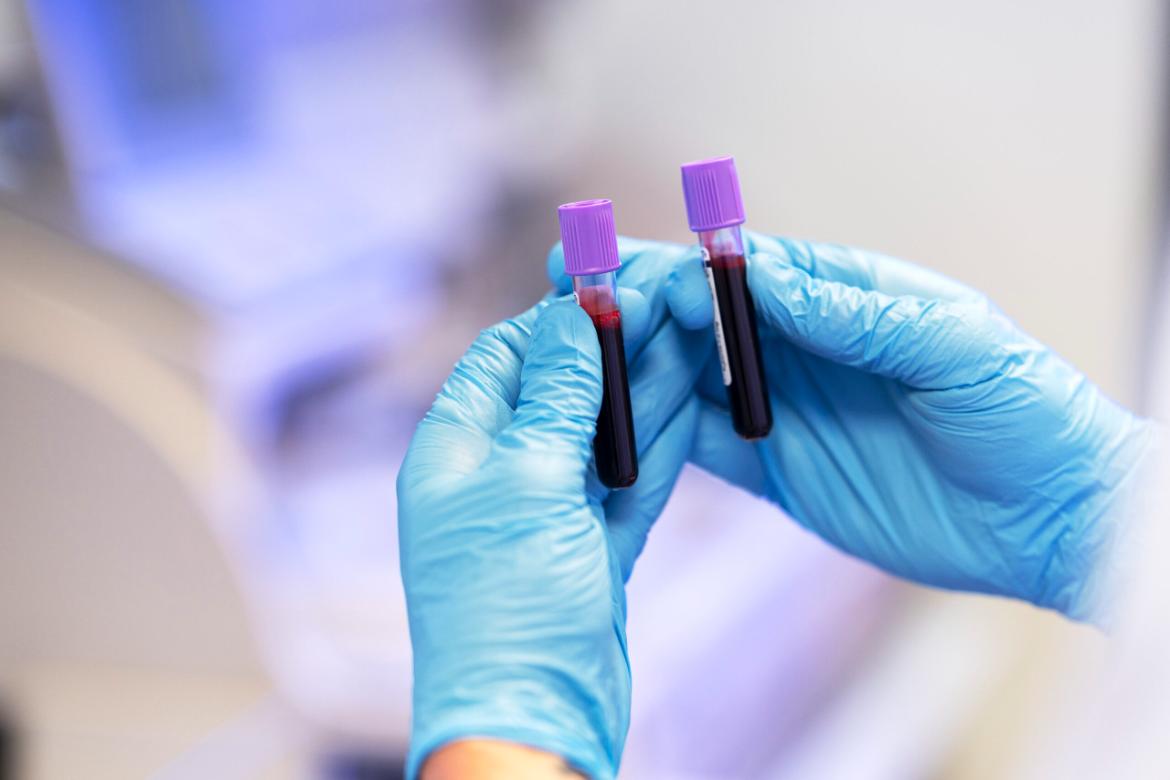 What is the Cortisol Hormone and What Does It Do?