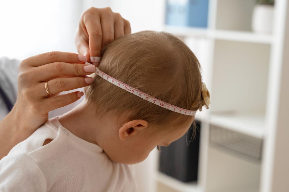 Craniosynostosis: Symptoms, Causes and Treatment Methods