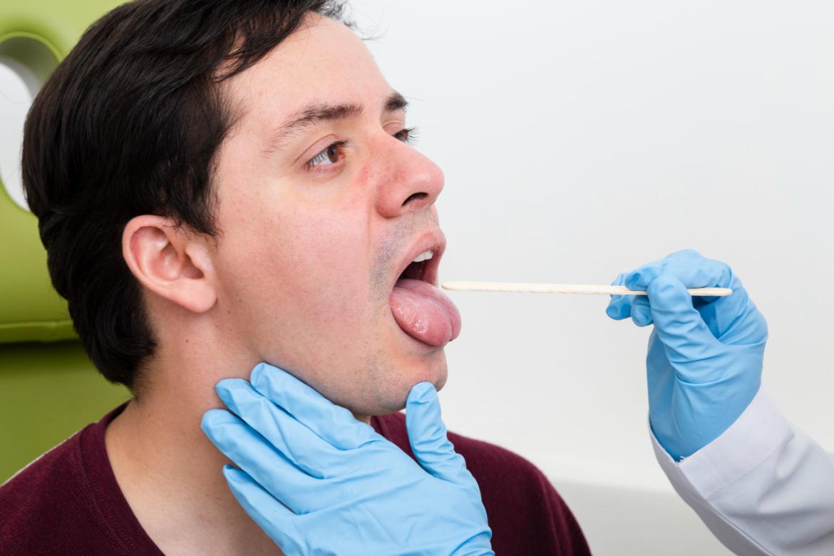 Uvula Swelling