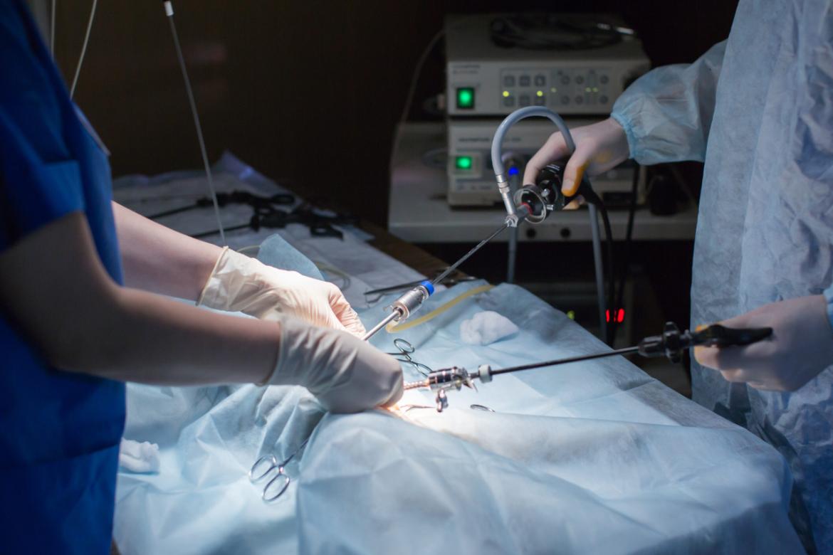 What is Laparoscopic Surgery?
