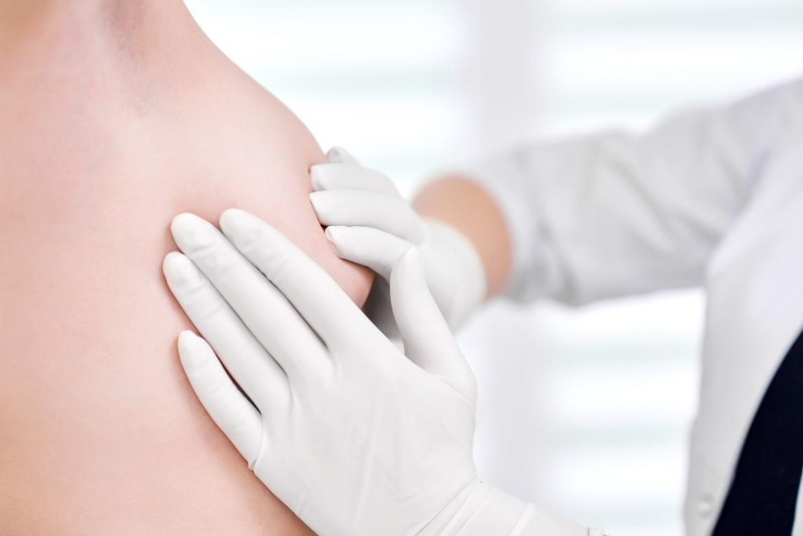 Breast Biopsy