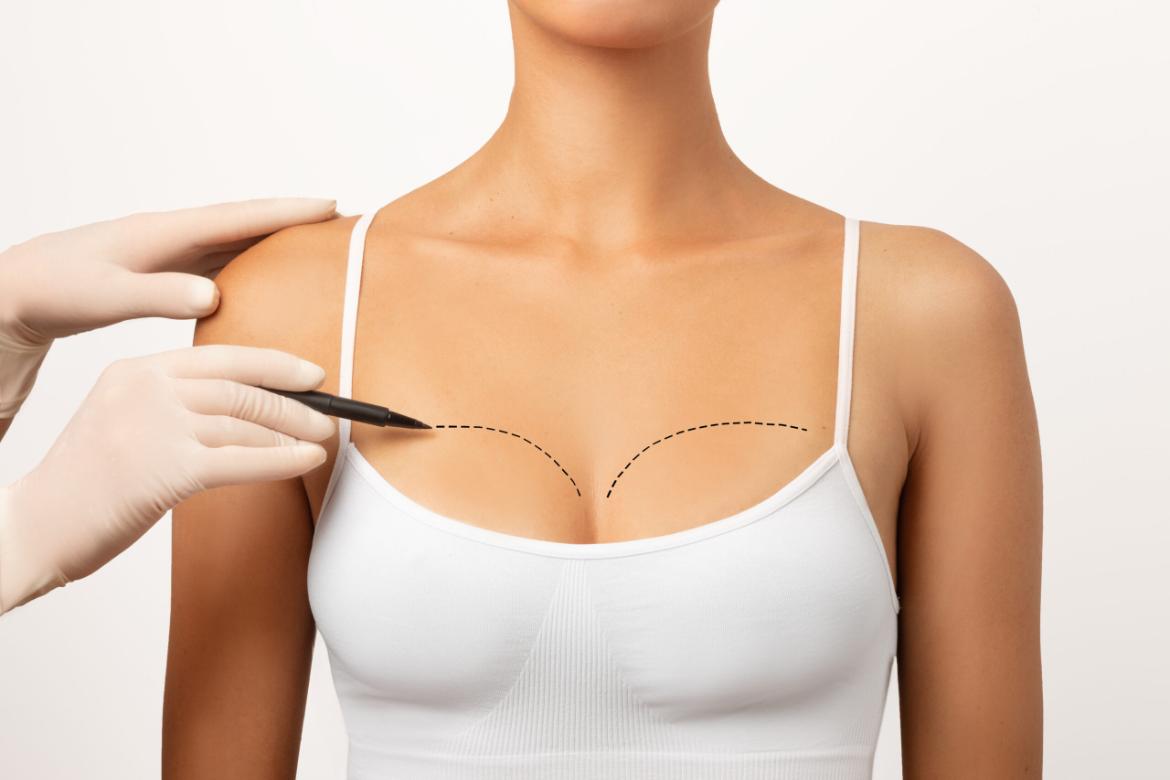 Breast Aesthetics