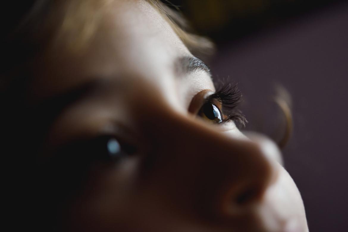 Nystagmus (Twitching Eyes)
