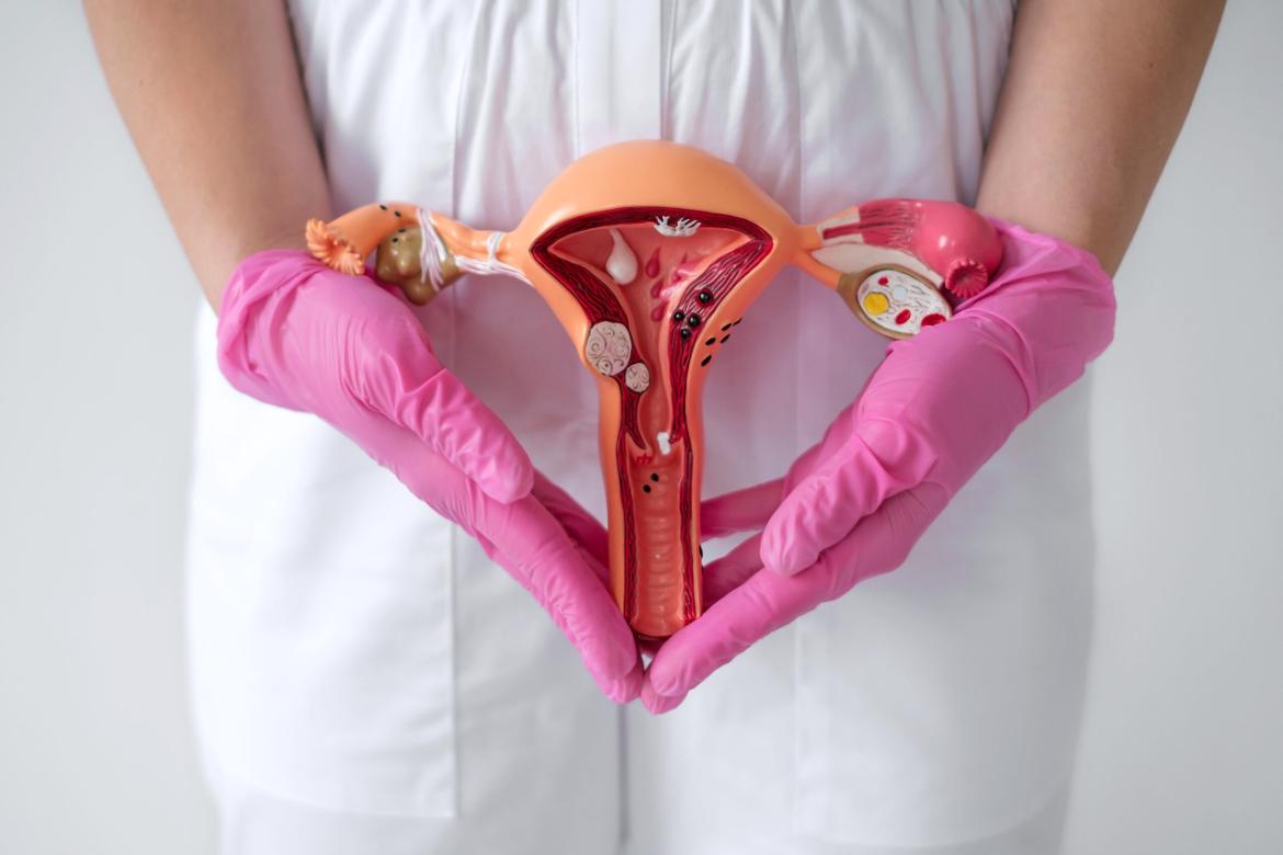 Oophorectomy (Ovarian Removal Surgery)