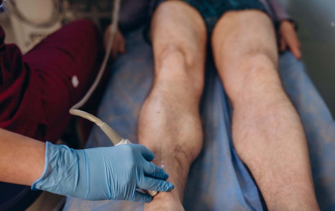 What is Peripheral Artery Disease?