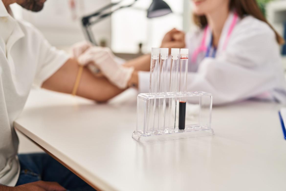 What is a PPD Test and How is it Performed?