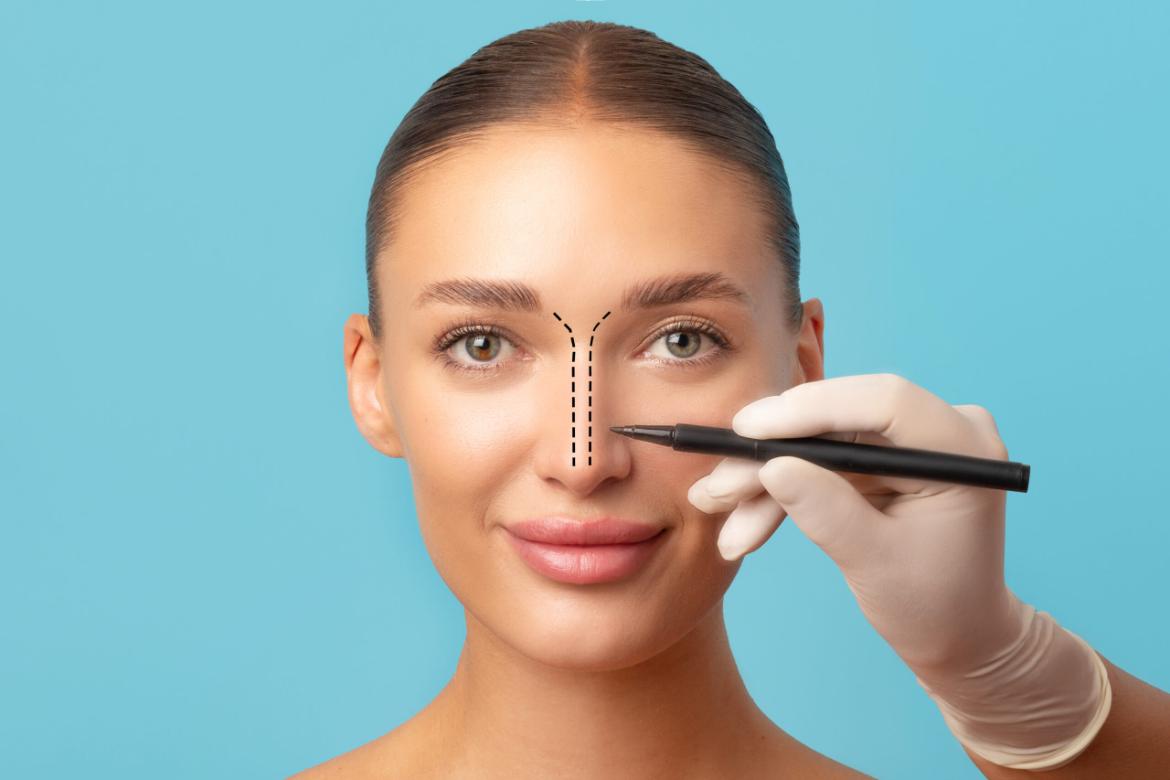 Rhinoplasty: Nose Aesthetic Surgery