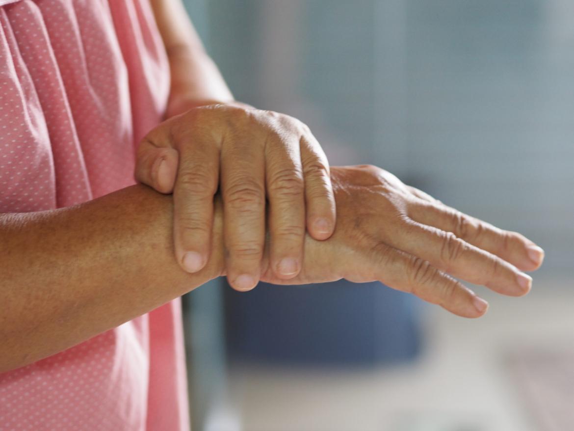 Rheumatoid Arthritis (Inflammatory Rheumatism)
