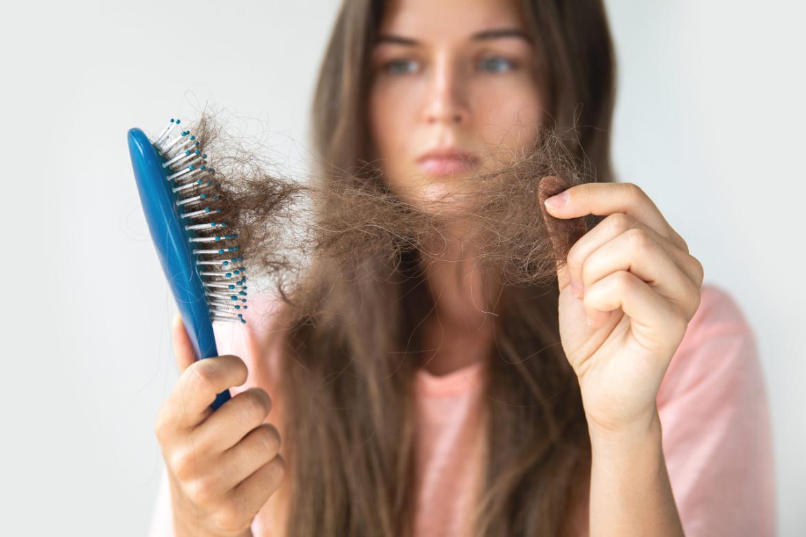 Causes of Hair Loss