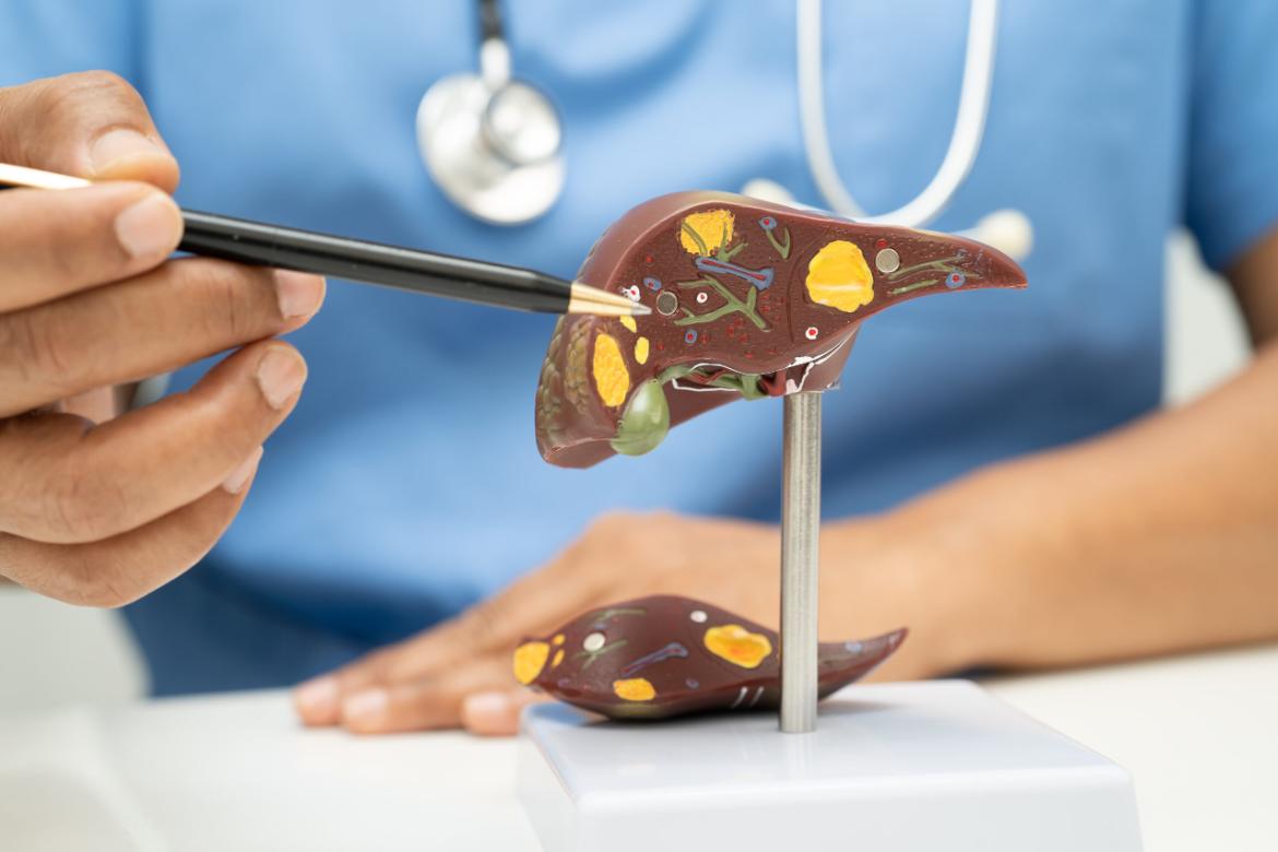 Gallbladder Inflammation (Cholecystitis)