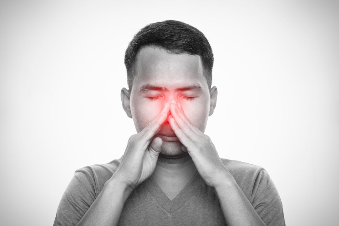 Sinusitis