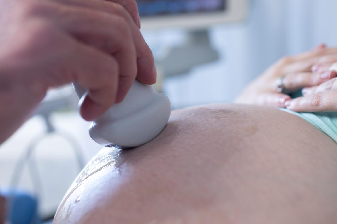 Induced Labor