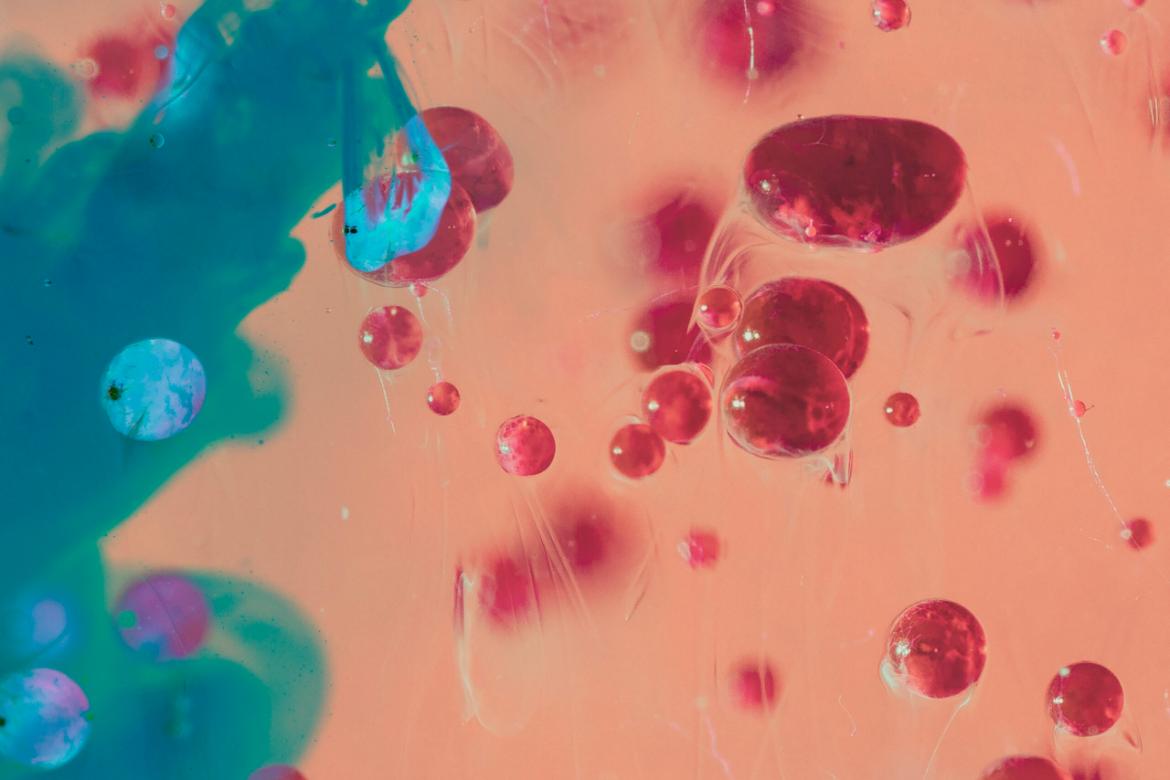 Toxoplasmosis