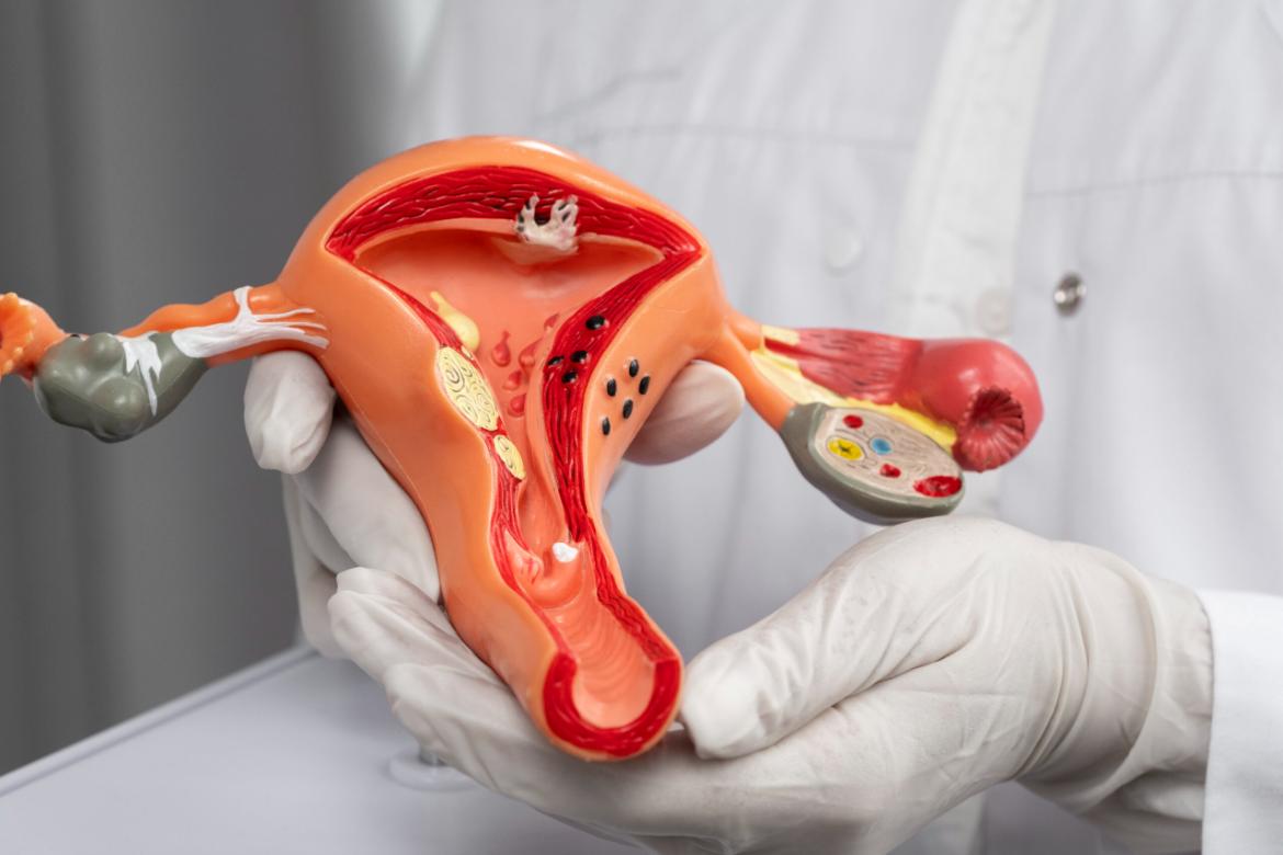Tubal Ligation (Cord Ligation) Surgery