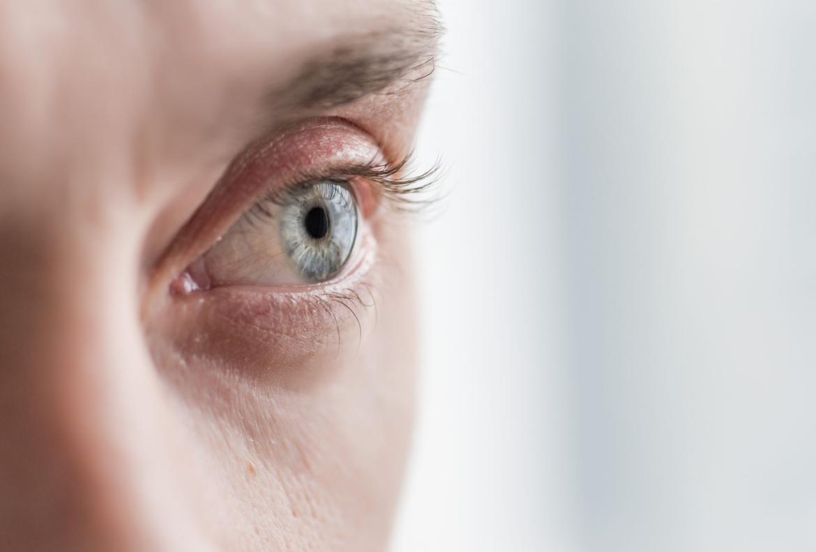 Uveitis